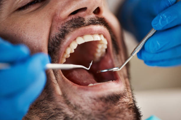 Best Emergency Broken Tooth Repair in Theresa, WI